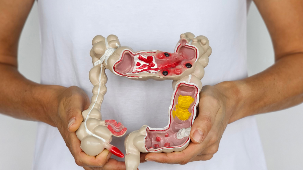 Bowel Disorders - Radiant Integrative Health Las Vegas NV