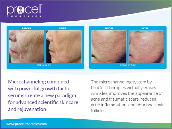 Procell Micro Channel Therapy - Radiant Integrative Health Las Vegas NV