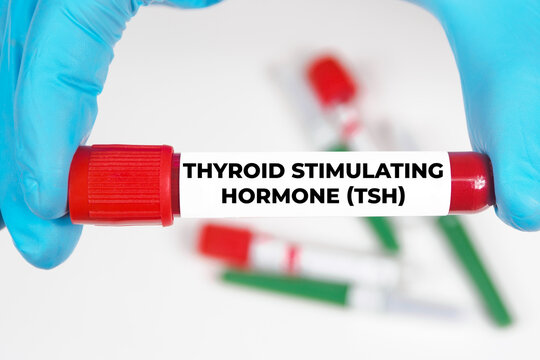 TSH Thyroid Stimulating Hormones-Radiant Integrative Health Las Vegas, NV